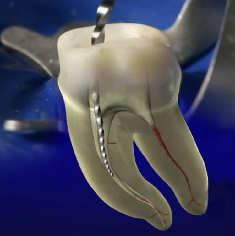 rotary endodontics course