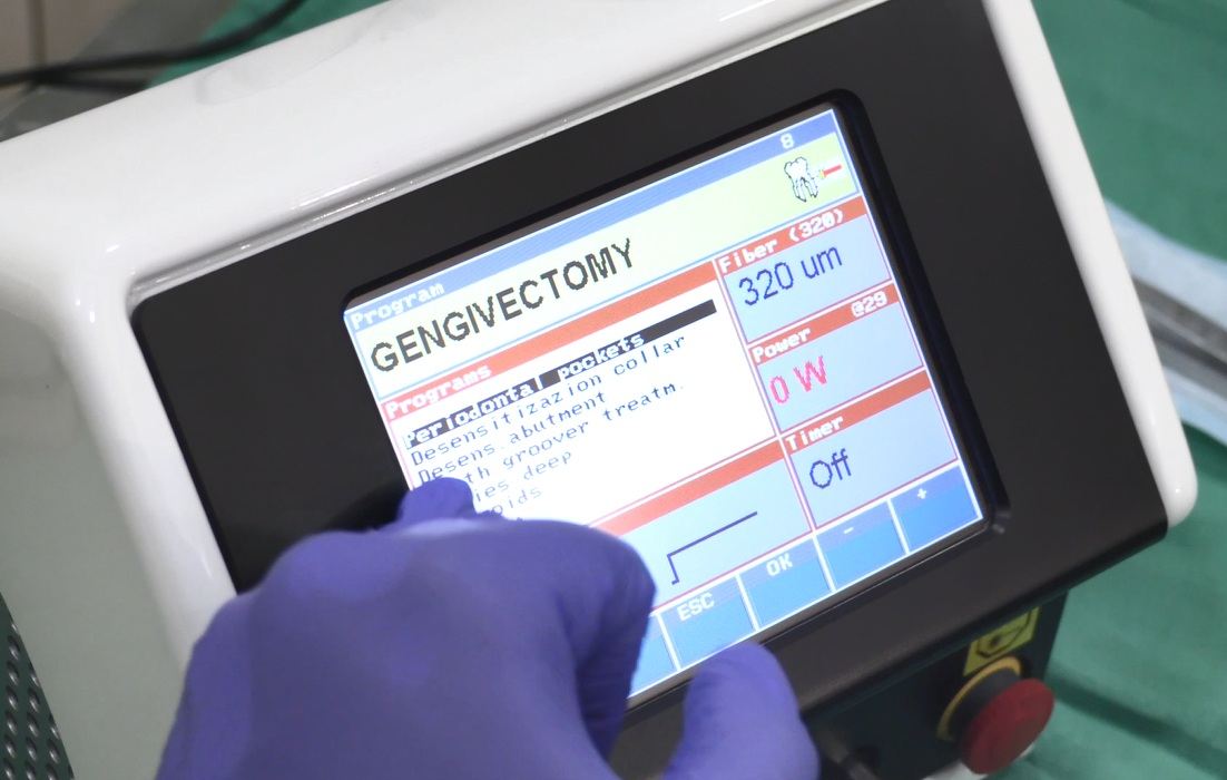 LASER Dentistry Courses in India Certified courses SSCDS GUIDE